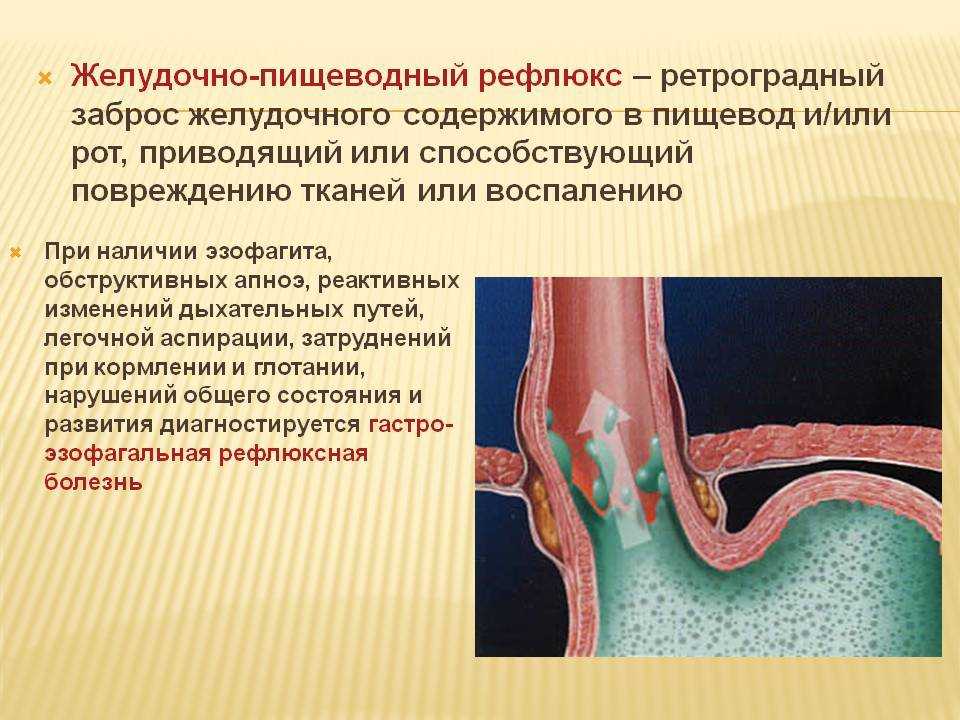 Лечение контрактура дюпюитрена без операции